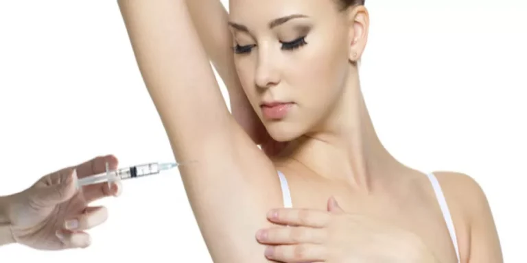 Read more about the article البوتوكس لعلاج التعرق