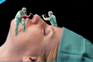 Read more about the article اسباب فشل عملية تجميل الانف