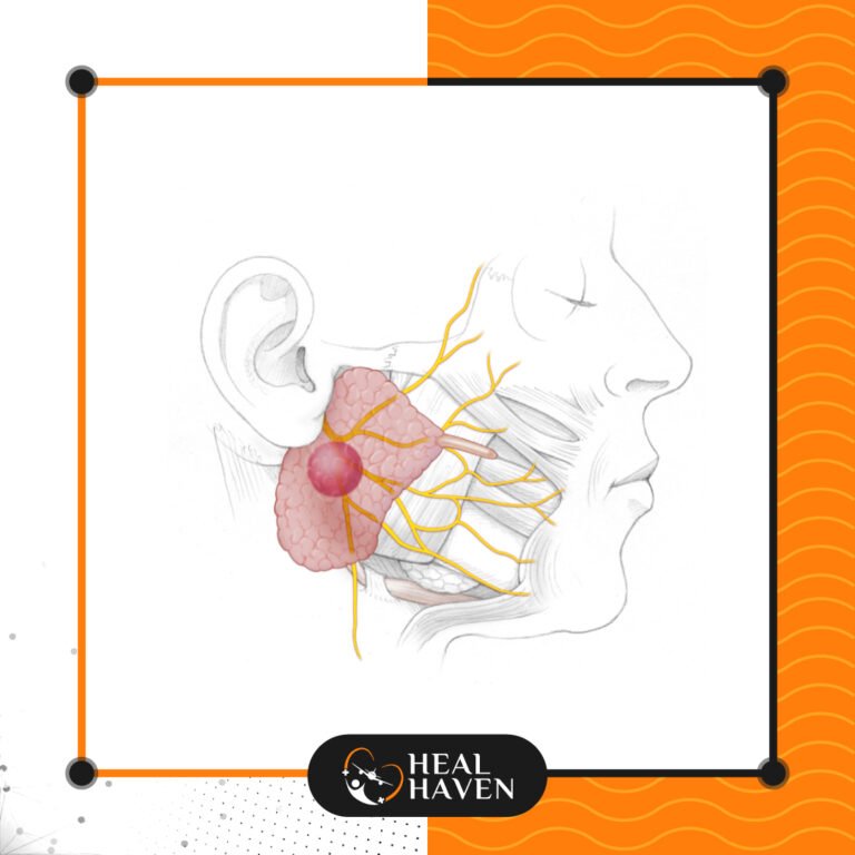 Read more about the article عمليات الغدد اللعابية